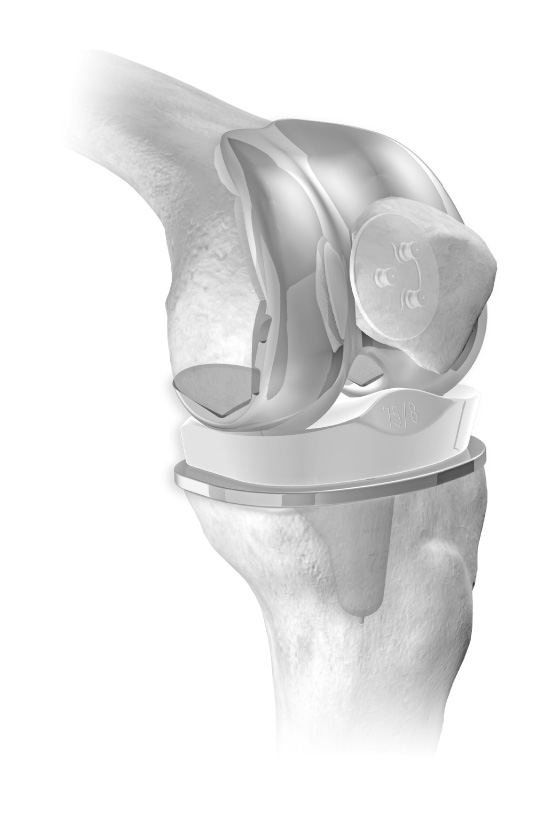 Versorgtes Knie